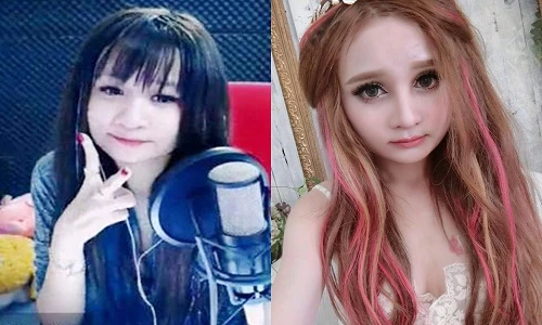 Những thay đổi gây choáng của "hot girl mặt vuông" sau gọt cằm