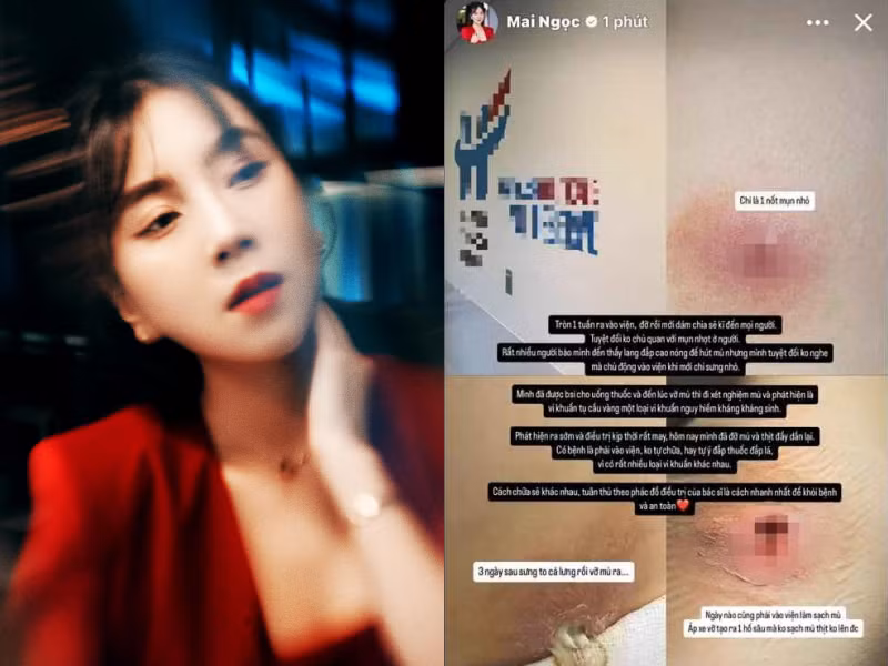 Sức khỏe MC Mai Ngọc ra sao sau 1 tuần vào viện?