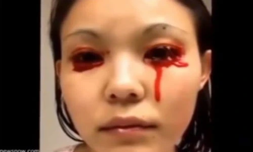 Rùng mình với cô gái khóc ra máu khi đang ngủ