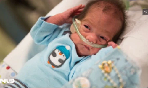 Kỳ lạ mẹ chết não vẫn sinh con khỏe mạnh