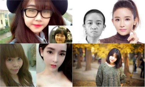 Những thiếu nữ Việt tự tin khoe nhiều lần dao kéo