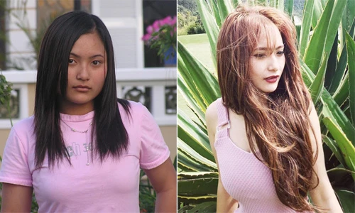 Sau tai nạn giao thông, cô gái Đà Lạt bất ngờ lột xác