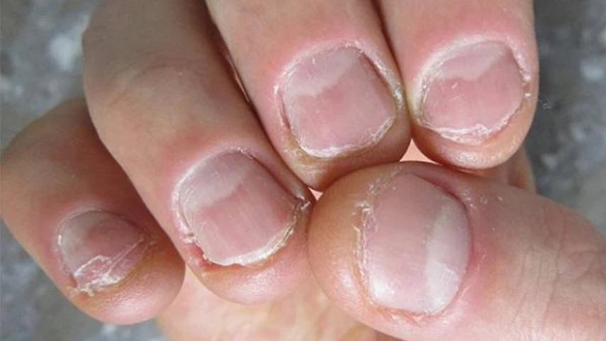 Nỗi khổ của “team tay xấu”, cả đời không dám đi làm nail