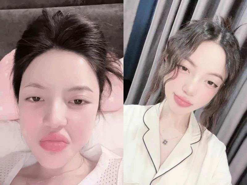 Xài app quá lố, vợ Quang Hải lộ gương mặt "biến dạng"