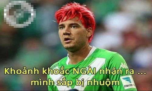 Ảnh chế Champions League: "Thánh" Bendtner lại bị nhuộm đỏ mái đầu