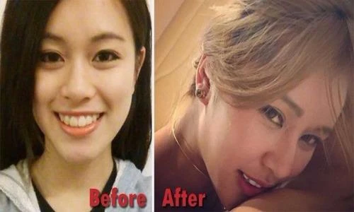 Thiếu nữ Hong Kong phẫu thuật 30 lần chiều lòng bạn trai