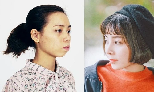 Bị chê "xấu như vượn", cô gái Thái Nguyên quyết phẫu thuật