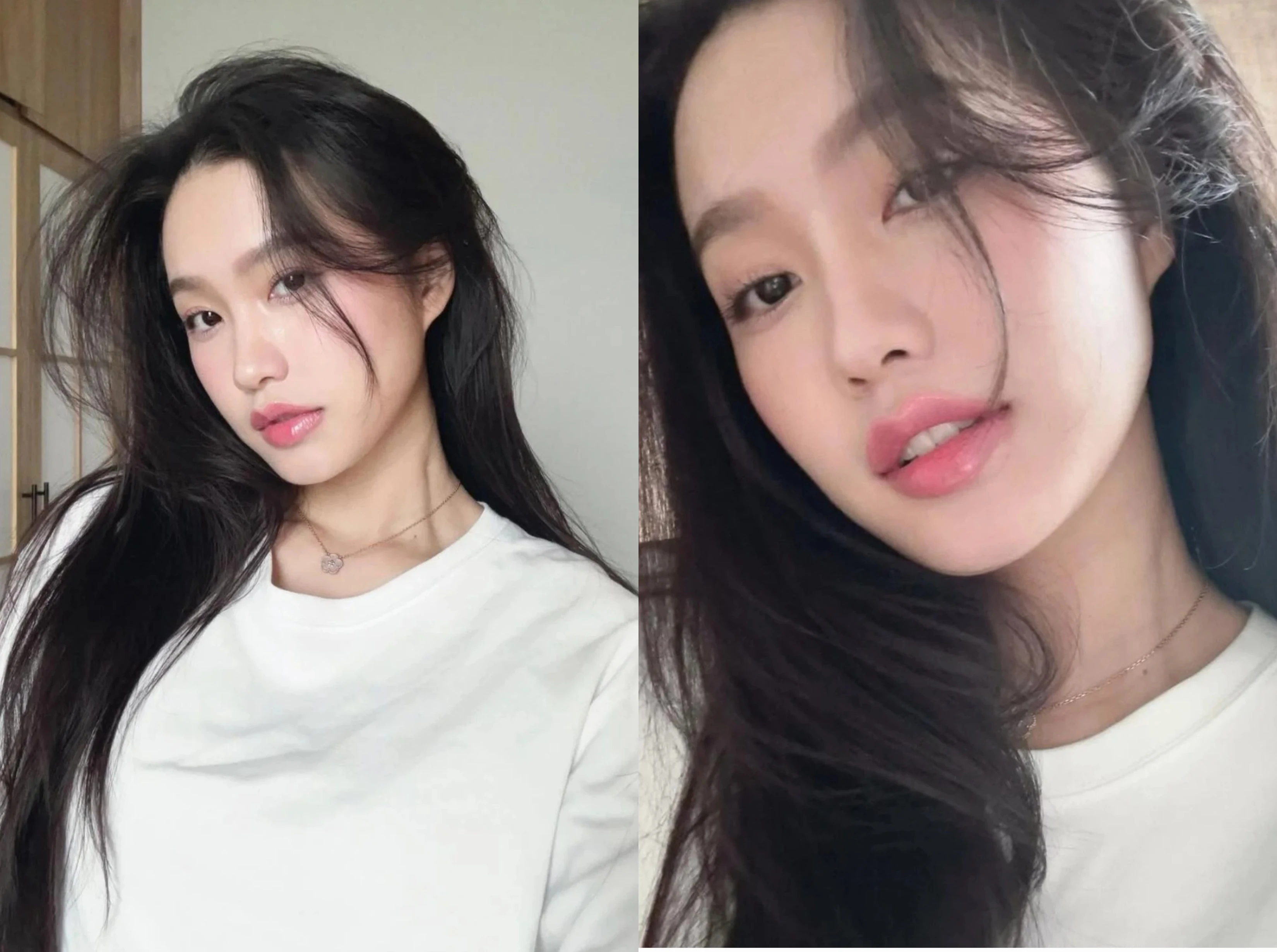 Đôi môi hiện tại của nàng WAGs Doãn Hải My giờ ra sao?