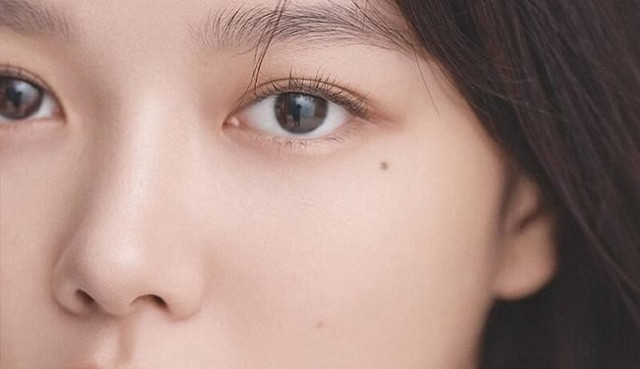 6 nốt ruồi tụ tài lộc, hút vận may, lỡ tay xóa là làm đâu hỏng đấy - Hình 3 6 not ruoi tu tai loc, hut van may, lo tay xoa la lam dau hong day-Hinh-3