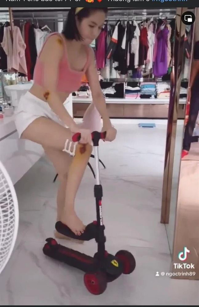 Ngọc Trinh công khai những vết xây xát khắp người sau khi ngã - Hình 2 Ngoc Trinh cong khai nhung vet xay xat khap nguoi sau khi nga-Hinh-2