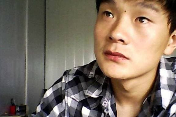 Những nốt ruồi này tốt nhất nên tẩy đi để tránh xui xẻo - Hình 6 Nhung not ruoi nay tot nhat nen tay di de tranh xui xeo-Hinh-6