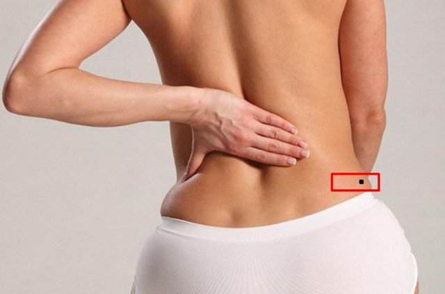Nốt ruồi bàn tọa - họa phúc khôn lường: Đúng sai thế nào? Not ruoi ban toa - hoa phuc khon luong: Dung sai the nao?