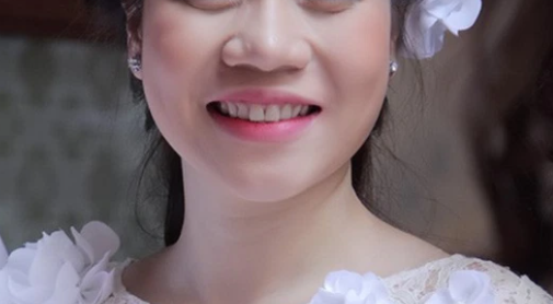 Tướng mũi nhiều người chê nhưng vượng tài lộc, đừng sửa kẻo mất vận sang giàu Tuong mui nhieu nguoi che nhung vuong tai loc, dung sua keo mat van sang giau