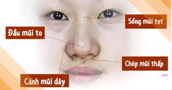 Tướng mũi nhiều người chê nhưng vượng tài lộc, đừng sửa kẻo mất vận sang giàu - Hình 2 Tuong mui nhieu nguoi che nhung vuong tai loc, dung sua keo mat van sang giau-Hinh-2