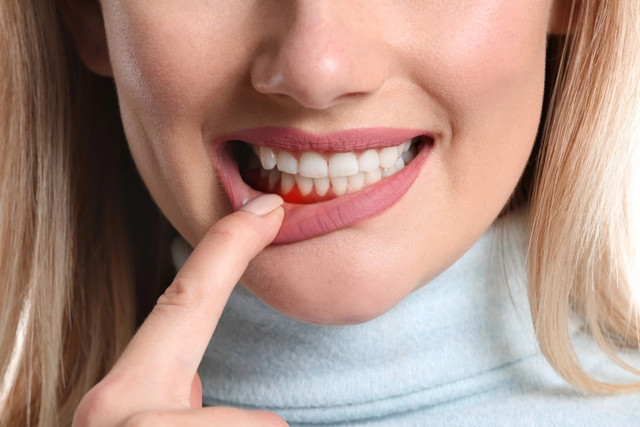 Đau tim, đột quỵ có thể do... lười đánh răng - Hình 2 Dau tim, dot quy co the do... luoi danh rang-Hinh-2