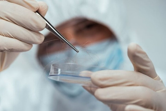 Mang tóc đi xét nghiệm ADN, người đàn ông U60 bật khóc - Hình 2 Mang toc di xet nghiem ADN, nguoi dan ong U60 bat khoc-Hinh-2