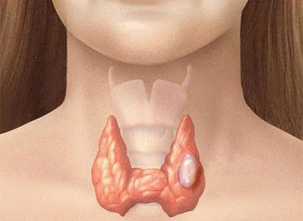 2 loại rau rút ngắn tuổi thọ nhưng mâm cơm người Việt hay có - Hình 3 2 loai rau rut ngan tuoi tho nhung mam com nguoi Viet hay co-Hinh-3