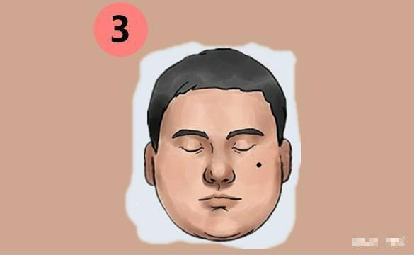 5 nốt ruồi tốt lành, công việc phát đạt, hôn nhân hạnh phúc - Hình 3 5 not ruoi tot lanh, cong viec phat dat, hon nhan hanh phuc-Hinh-3