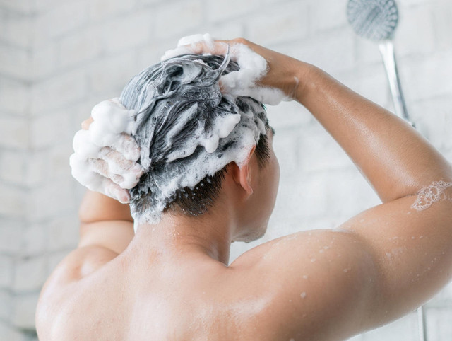 Căn bệnh có thể gây rụng tóc vĩnh viễn - Hình 2 Can benh co the gay rung toc vinh vien-Hinh-2