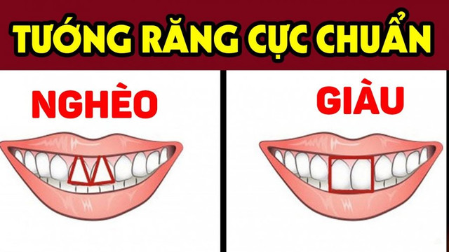 Dù nam hay nữ nếu sở hữu 4 tướng răng này thường nghèo khổ, tình duyên lận đận Du nam hay nu neu so huu 4 tuong rang nay thuong ngheo kho, tinh duyen lan dan