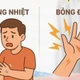 Nhiều ca bỏng nặng do sinh hoạt, người dân cần biết cách sơ cứu