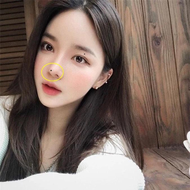 5 nốt ruồi bất ngờ xuất hiện điềm báo xui xẻo cả tiền lẫn tình - Hình 2 5 not ruoi bat ngo xuat hien diem bao xui xeo ca tien lan tinh-Hinh-2