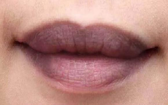 Đoán bệnh qua màu sắc của môi - Hình 2 Doan benh qua mau sac cua moi-Hinh-2