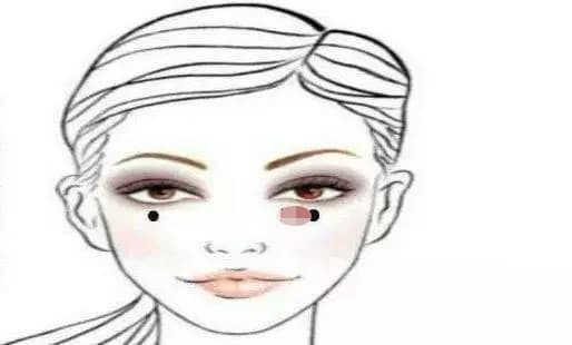 Trên mặt có 5 nốt ruồi này cuộc đời thật gập ghềnh - Hình 2 Tren mat co 5 not ruoi nay cuoc doi that gap ghenh-Hinh-2