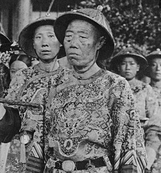 Lý do thái giám cổ đại quấn khăn quanh eo cả đời Ly do thai giam co dai quan khan quanh eo ca doi
