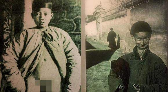 Lý do thái giám cổ đại quấn khăn quanh eo cả đời - Hình 2 Ly do thai giam co dai quan khan quanh eo ca doi-Hinh-2