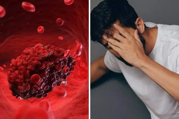 2 thực phẩm có tác dụng "phá vỡ" cục máu đông 2 thuc pham co tac dung