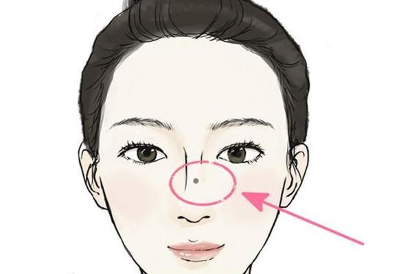 5 nốt ruồi phá tướng mặt phụ nữ, cả đời long đong tình lẫn tiền - Hình 5 5 not ruoi pha tuong mat phu nu, ca doi long dong tinh lan tien-Hinh-5