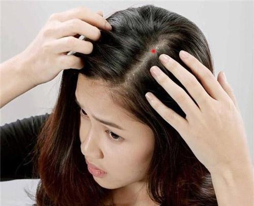 Phụ nữ sở hữu nốt ruồi cả đời "ăn trên ngồi chốc", giàu khủng - Hình 3 Phu nu so huu not ruoi ca doi