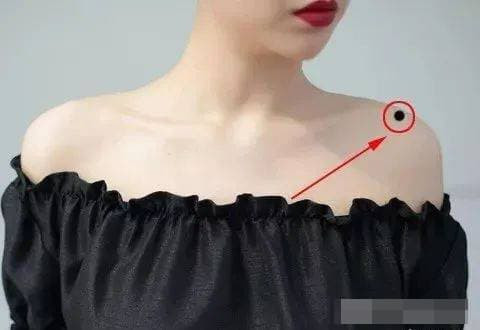 5 nốt ruồi may mắn, lỡ dại xóa đi là mất hết lộc - Hình 3 5 not ruoi may man, lo dai xoa di la mat het loc-Hinh-3