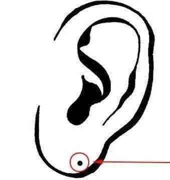 5 nốt ruồi may mắn, lỡ dại xóa đi là mất hết lộc - Hình 2 5 not ruoi may man, lo dai xoa di la mat het loc-Hinh-2