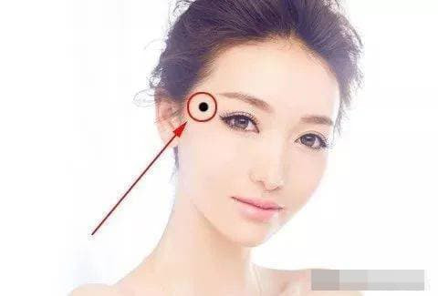 5 nốt ruồi may mắn, lỡ dại xóa đi là mất hết lộc - Hình 4 5 not ruoi may man, lo dai xoa di la mat het loc-Hinh-4