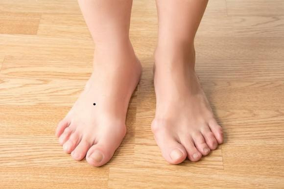 Nhìn vị trí của nốt ruồi biết ngay giàu sang hay nghèo khó - Hình 2 Nhin vi tri cua not ruoi biet ngay giau sang hay ngheo kho-Hinh-2