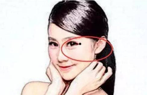 Nốt ruồi vượng phu trên cơ thể có thể kiếm được nhiều tiền - Hình 3 Not ruoi vuong phu tren co the co the kiem duoc nhieu tien-Hinh-3
