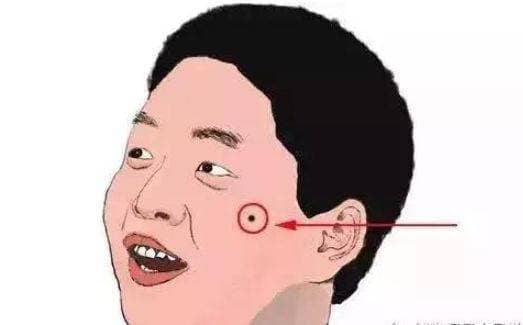 Nốt ruồi vượng phu trên cơ thể có thể kiếm được nhiều tiền Not ruoi vuong phu tren co the co the kiem duoc nhieu tien