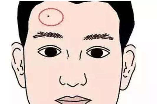 Nốt ruồi vượng phu trên cơ thể có thể kiếm được nhiều tiền - Hình 4 Not ruoi vuong phu tren co the co the kiem duoc nhieu tien-Hinh-4