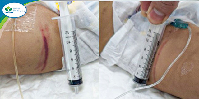 Sức khoẻ bé gái nghi bị 2 vợ chồng bảo mẫu bạo hành - Hình 2 Suc khoe be gai nghi bi 2 vo chong bao mau bao hanh-Hinh-2