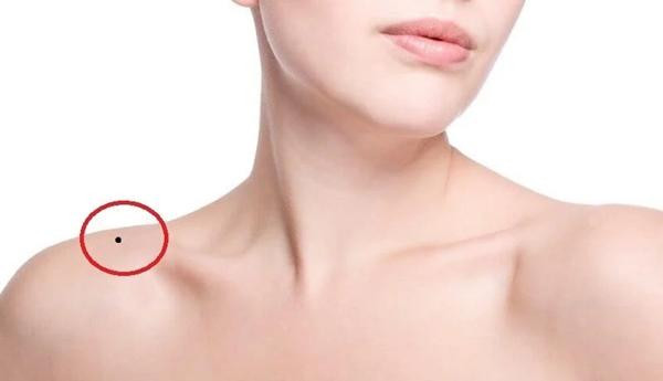 4 nốt ruồi làm rò rỉ tiền bạc, nên xóa càng sớm càng tốt 4 not ruoi lam ro ri tien bac, nen xoa cang som cang tot