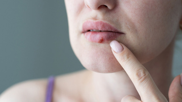 Chữa khỏi ung thư giai đoạn cuối nhờ loại virus quen thuộc - Hình 3 Chua khoi ung thu giai doan cuoi nho loai virus quen thuoc-Hinh-3