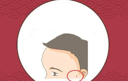 Với 4 nốt ruồi “khó ở” trên cơ thể, cả đời không có tiền - Hình 3 Voi 4 not ruoi “kho o” tren co the, ca doi khong co tien-Hinh-3