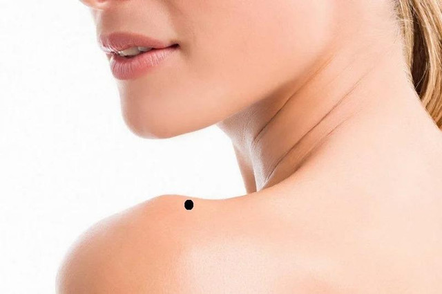 3 nốt ruồi tụ lộc chủ nhân giàu có, 2 vị trí phá tướng - Hình 2 3 not ruoi tu loc chu nhan giau co, 2 vi tri pha tuong-Hinh-2