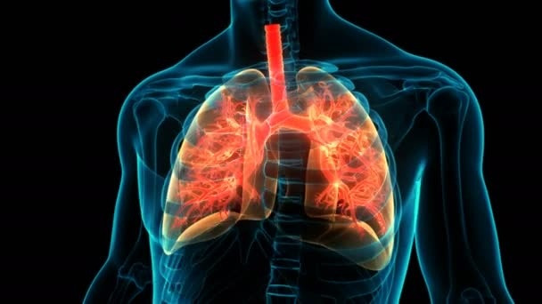 Những bệnh truyền nhiễm gây tử vong nhiều nhất thế giới Nhung benh truyen nhiem gay tu vong nhieu nhat the gioi