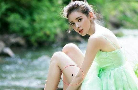 Người có những “nốt ruồi may mắn” này trên cơ thể sẽ tốt - Hình 2 Nguoi co nhung “not ruoi may man” nay tren co the se tot-Hinh-2
