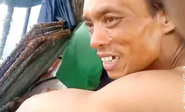 Người đàn ông bị hành hạ trên tàu cá có tỷ lệ thương tích 48% - Hình 2 Nguoi dan ong bi hanh ha tren tau ca co ty le thuong tich 48%-Hinh-2
