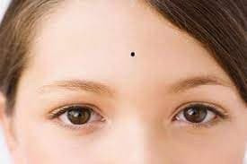 Nốt ruồi nghèo khó mọc ở đâu? Nốt ruồi sẽ giàu trong tương lai? Not ruoi ngheo kho moc o dau? Not ruoi se giau trong tuong lai?