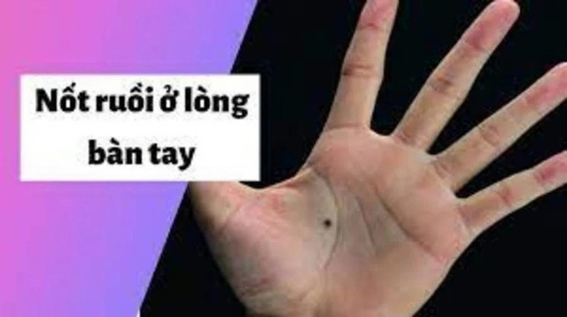 4 nốt ruồi: Đàn ông kiếm ra tiền, đàn bà làm ra vàng 4 not ruoi: Dan ong kiem ra tien, dan ba lam ra vang